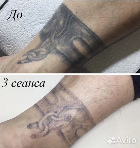 Как сделать tattoo kyiv бесплатно за 24 часа или меньше